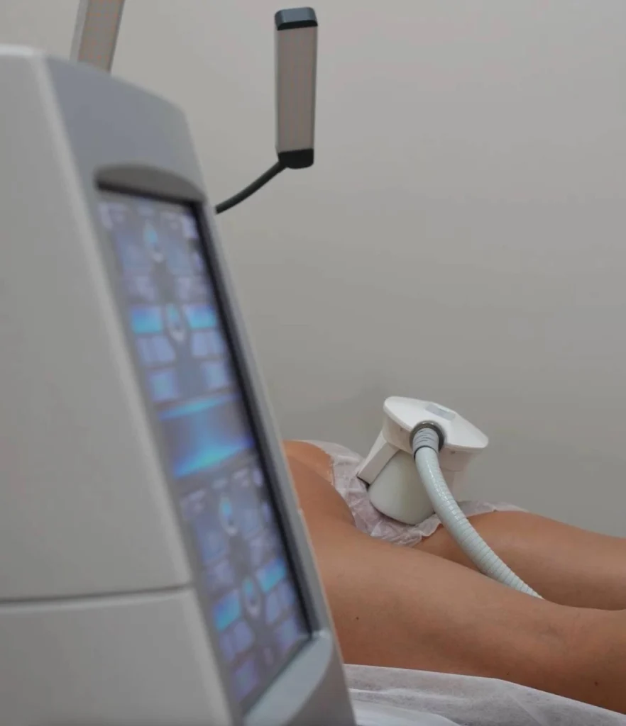 Кріоліполіз CoolShaping2 — апаратне зменшення жирових відкладень і моделювання контурів тіла.