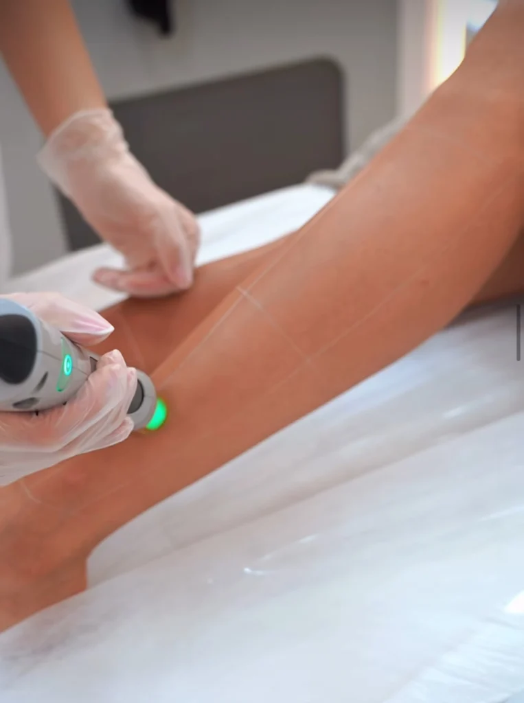 Лазерна епіляція Candela GentleLase Pro-U / Asclepion EpiLab — безболісне видалення волосся, гладка шкіра.
